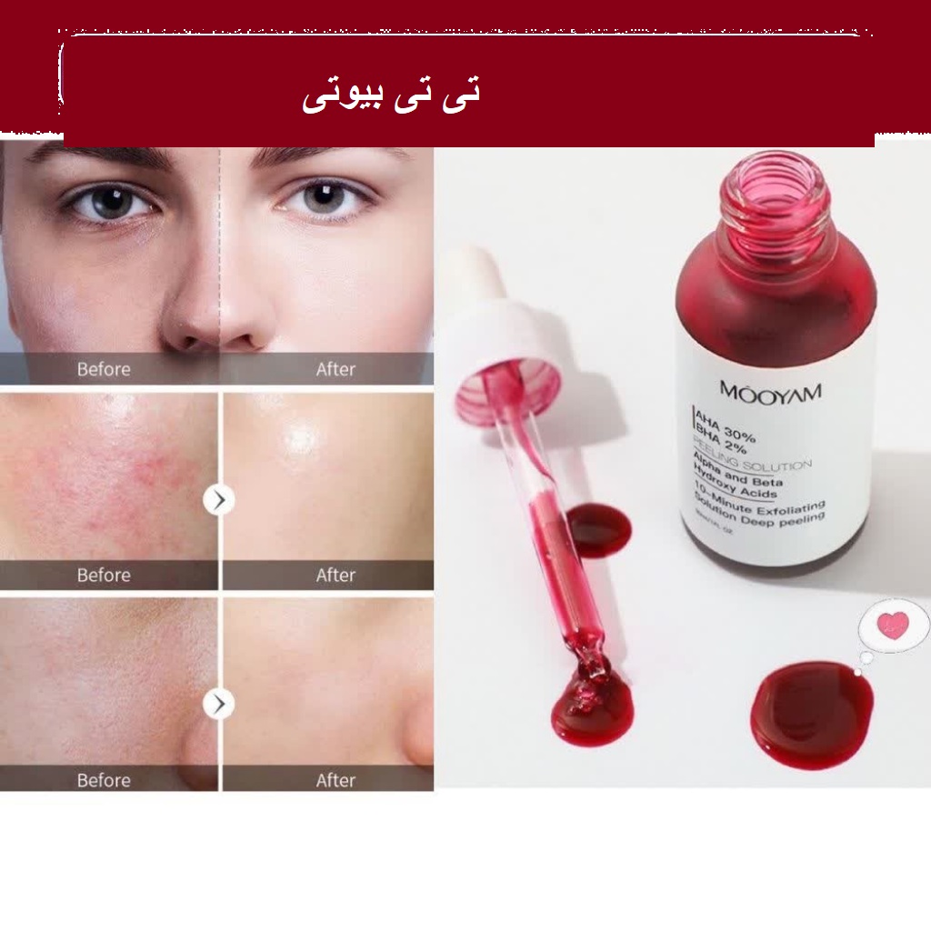 سرم آنزیمی پیلینگ مویام
